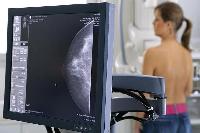 В ишимскую областную больницу закуплен рентгеновский цифровой маммограф